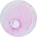 Ductus Deferens
